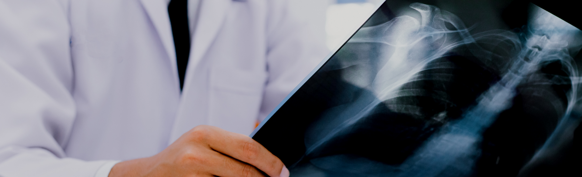 Understanding Lung Cancer
